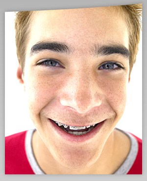 photo of boy wearing braces